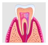 root_canal1 root_canal1